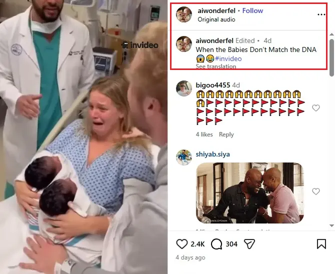 Video of white woman giving birth to dark-skinned twin is AI-generated. 